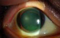 眼の病気Q＆A